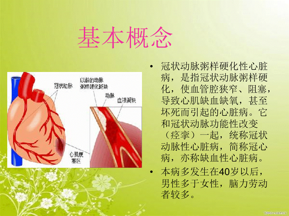 冠心病护理查房PPT课件下载推荐.ppt_第2页