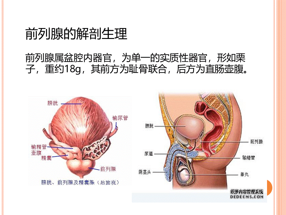 前列腺癌护理PPT格式课件下载.ppt_第3页