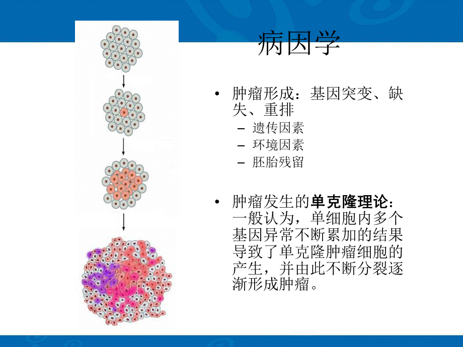 颅内肿瘤ppt课件PPT课件下载推荐.ppt_第3页