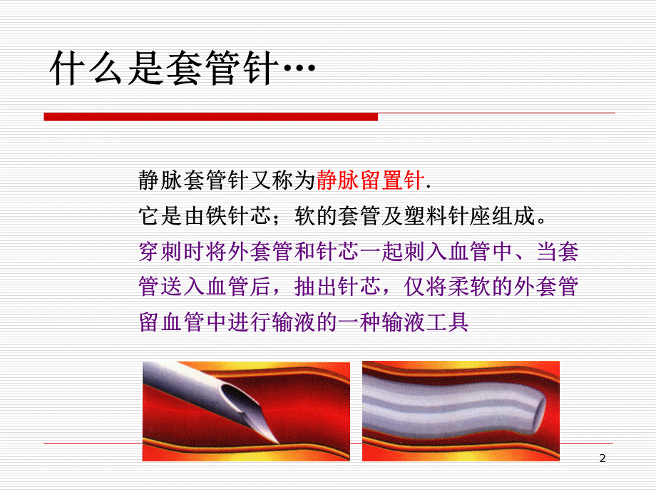 静脉留置针应用及封管ppt课件.ppt_第2页