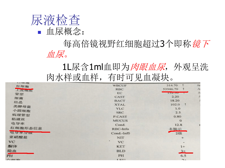 肾内科知识.ppt_第3页