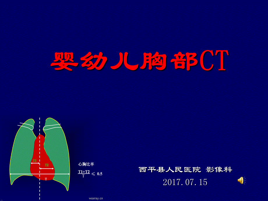 儿童胸部CT.ppt