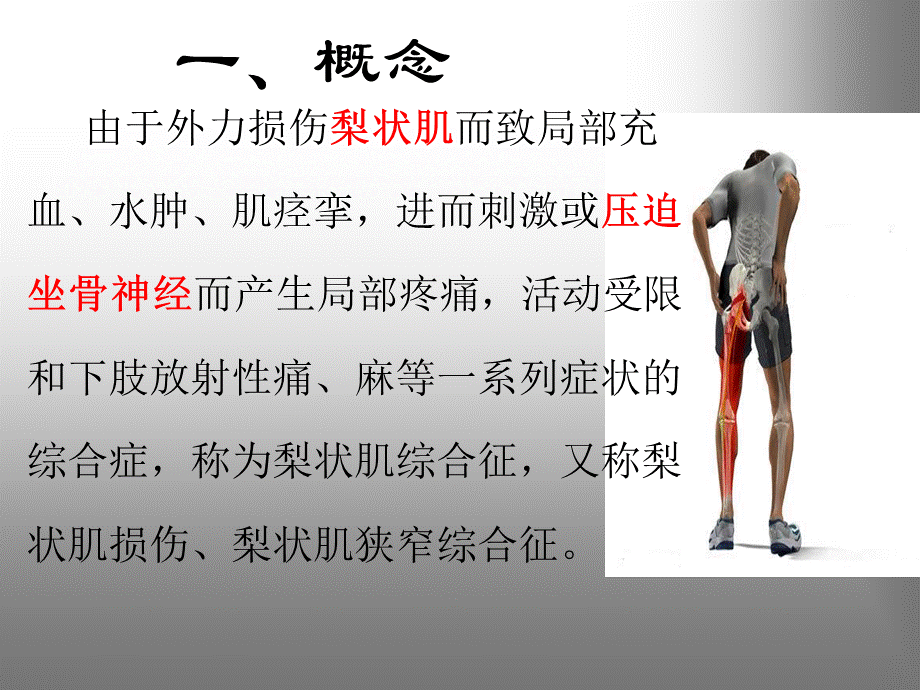 梨状肌综合征优质PPT.ppt_第2页