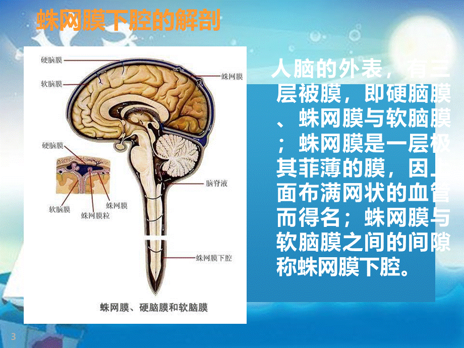 例蛛网膜下腔出血患者护理查房幻灯片 (1).ppt_第3页