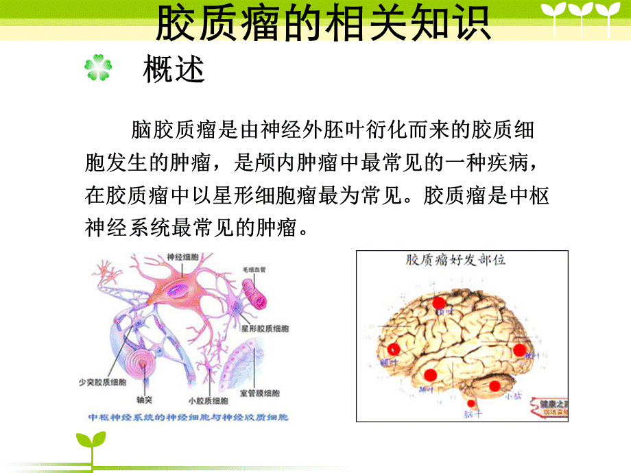 胶质瘤患者的术后护理PPT资料.ppt_第3页