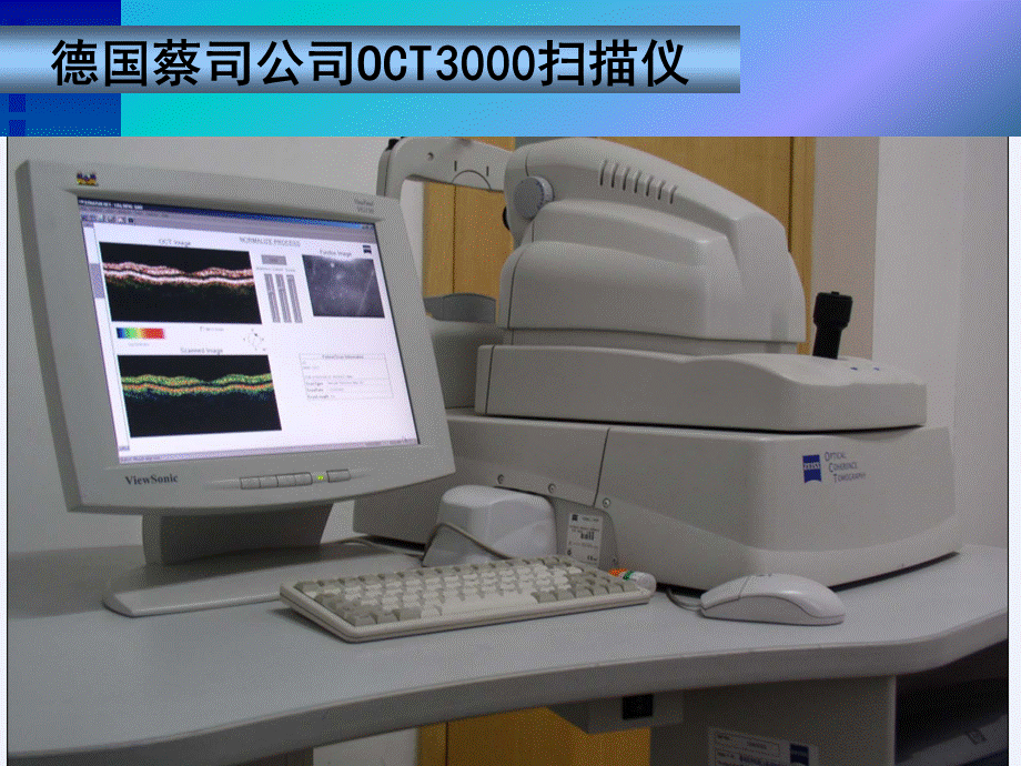 oct简介及其临床应用.ppt_第3页