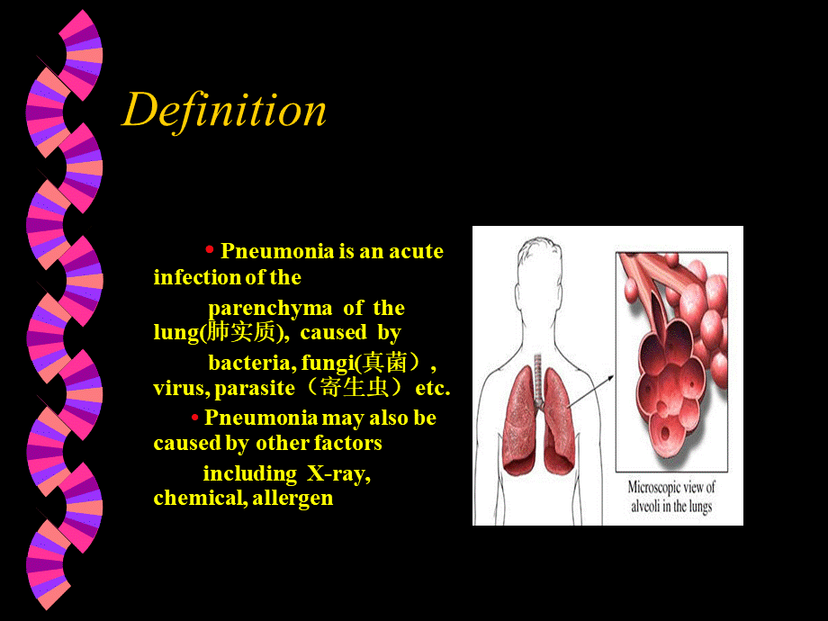 Pneumonia课件PPT推荐.ppt_第2页