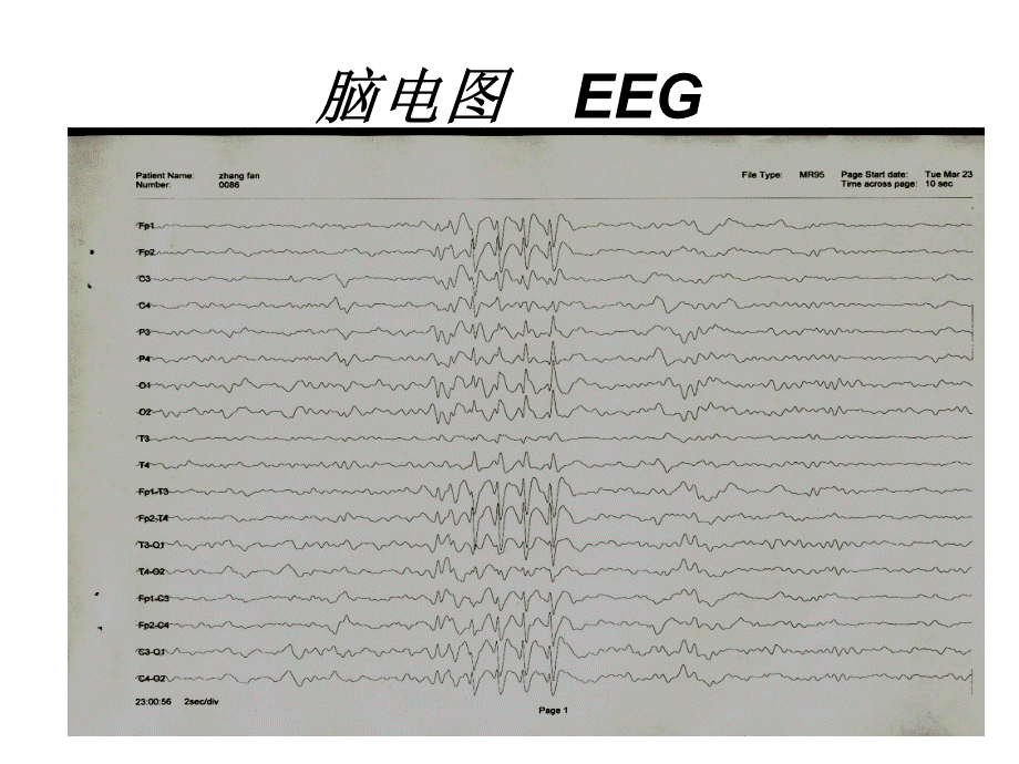 脑电图PPT文件格式下载.ppt_第3页