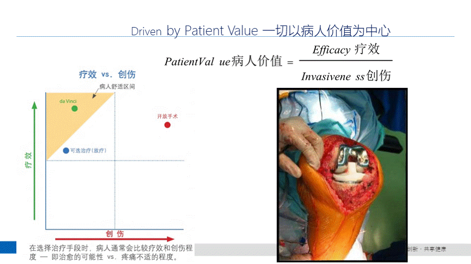 计算机辅助导航技术在骨科的应用基础及MAKO简介优质PPT.pptx_第3页