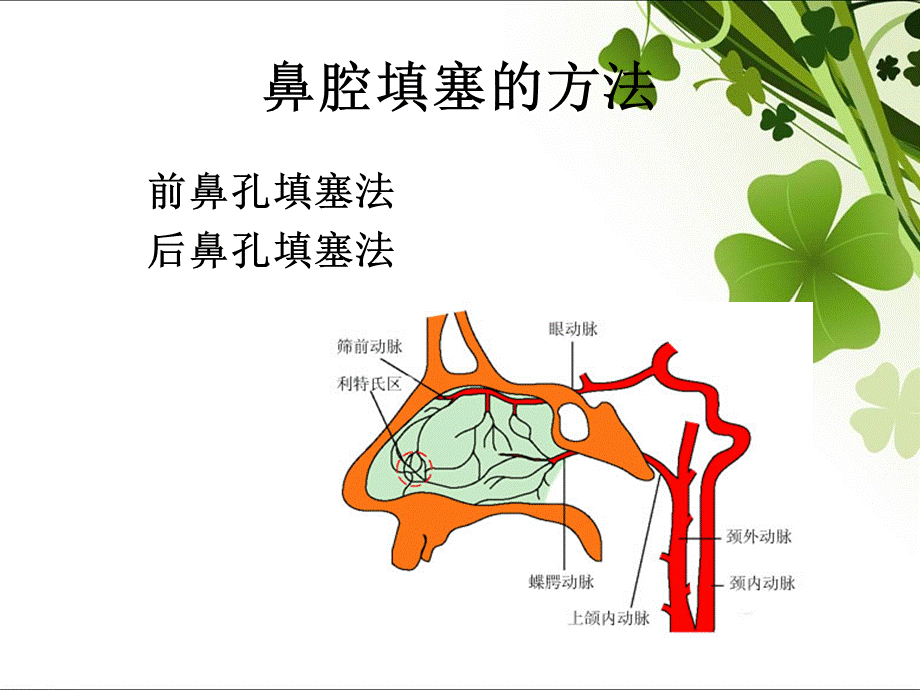 鼻腔填塞PPT文件格式下载.ppt_第3页