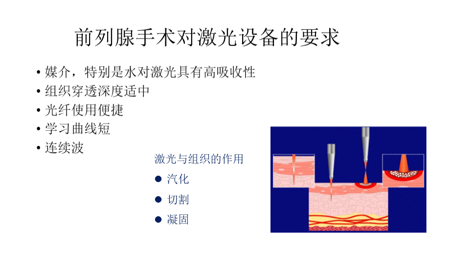 nm激光前列腺剜出术.pptx_第2页