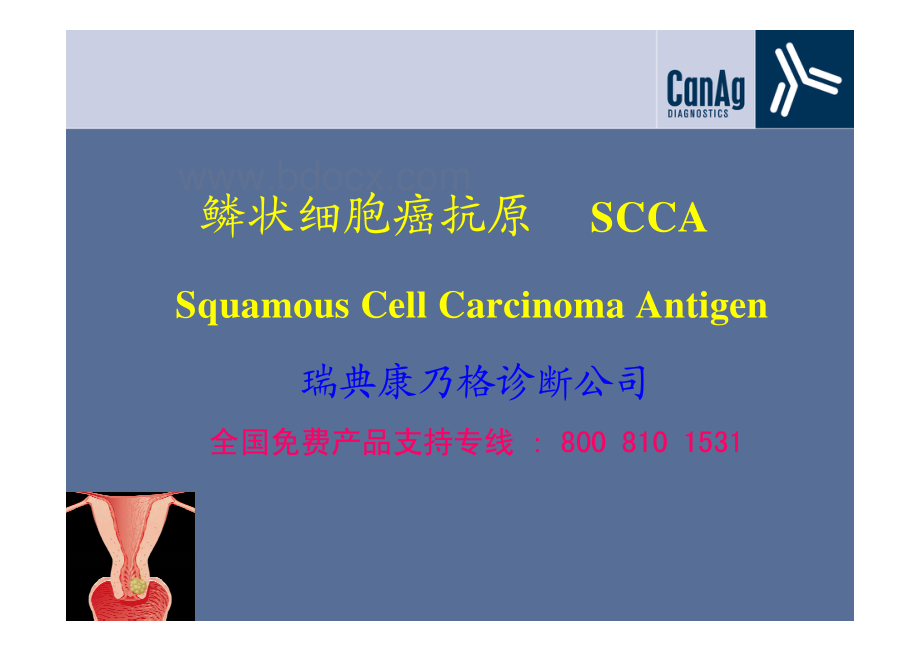 鳞状细胞癌抗原SCCA资料下载.pdf_第1页