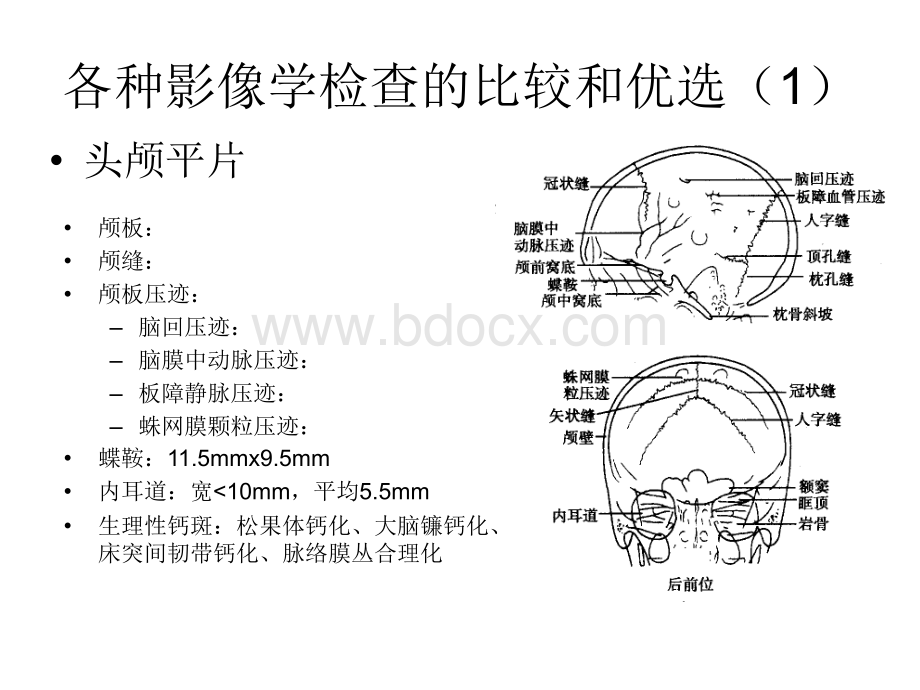 4中枢神经系统1.ppt_第3页