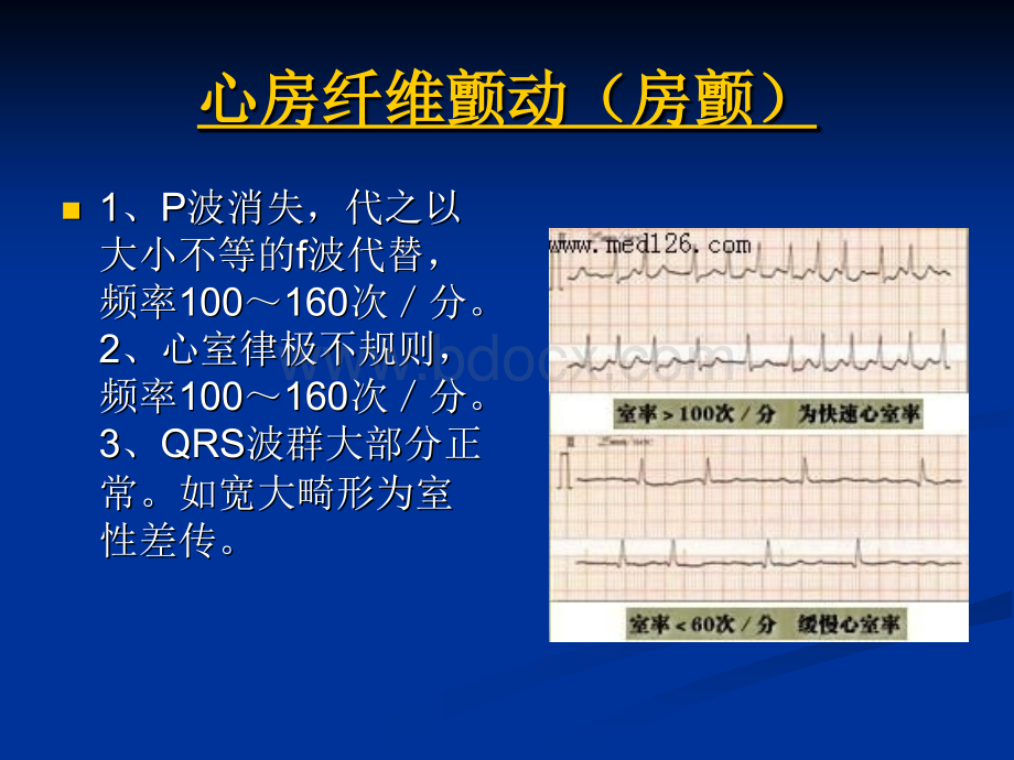 心房纤维颤动房颤.ppt