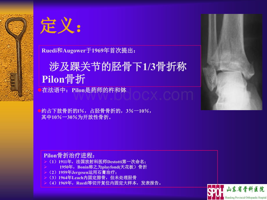 Pilon骨折的治疗PPT课件下载推荐.ppt_第2页