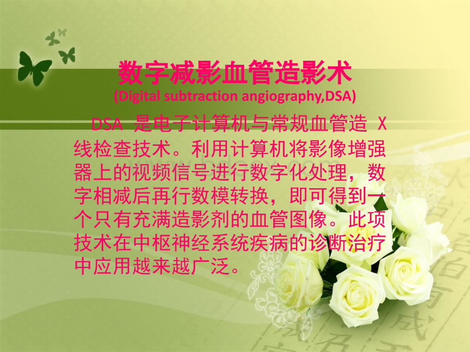 如何阅读脑血管DSA片.ppt_第1页