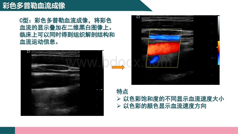 彩色多普勒超声成像原理.pptx_第2页