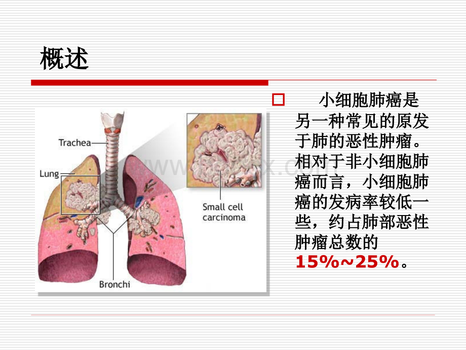 小细胞肺癌PPT课件PPT推荐.ppt_第2页