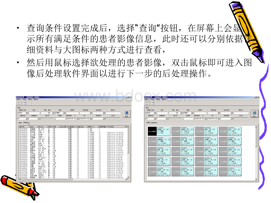 10医学图像后处理技术PPT资料.ppt_第3页