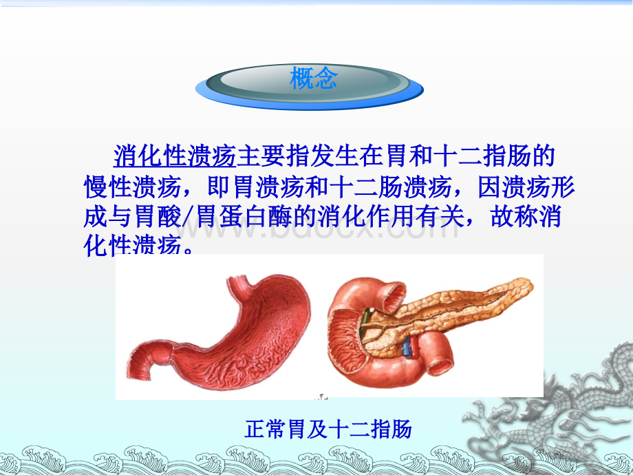 消化性溃疡的护理.ppt_第2页