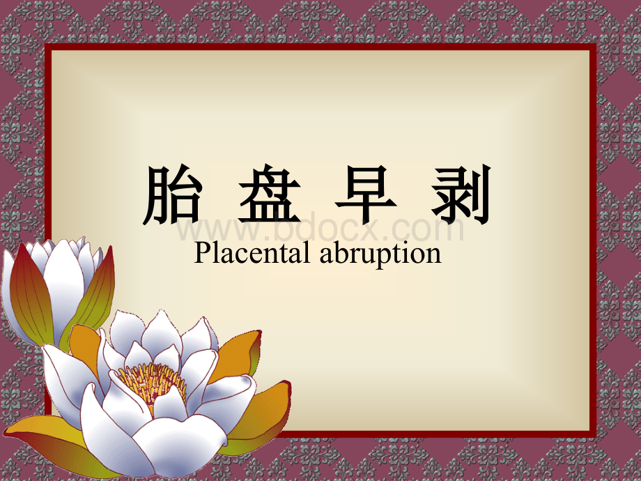 新胎盘早剥的护理优质PPT.ppt_第2页