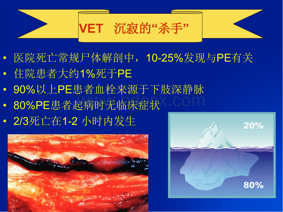 VTE预防的护理管理1PPT资料.ppt_第3页