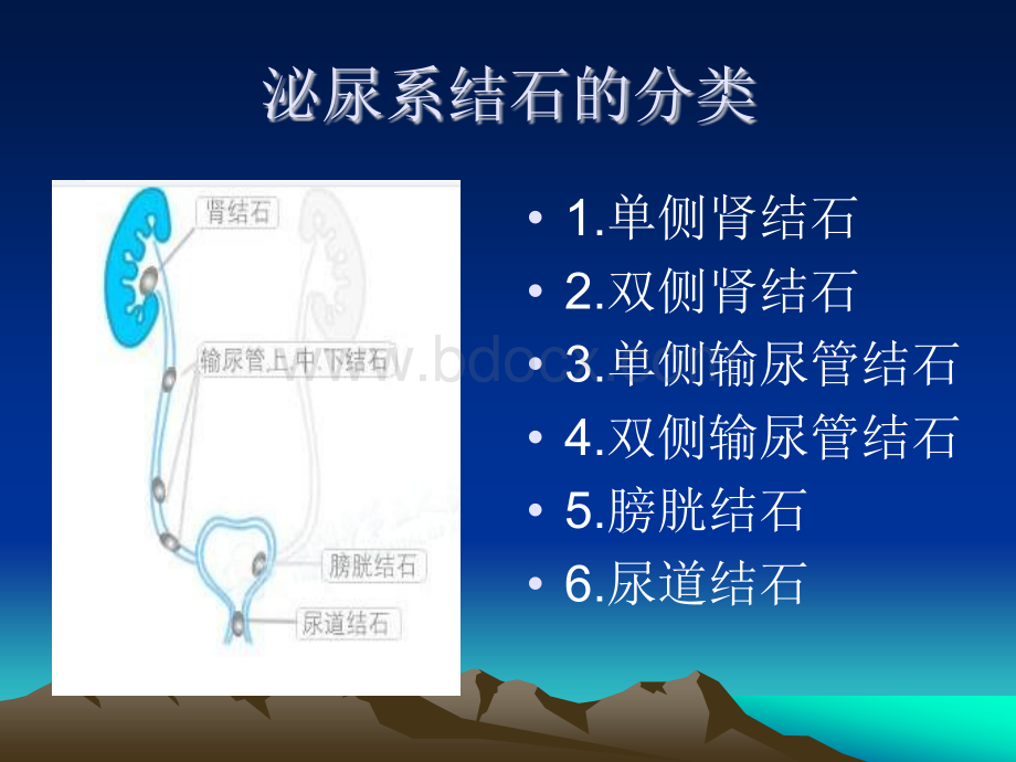 泌尿系结石的治疗.ppt_第2页