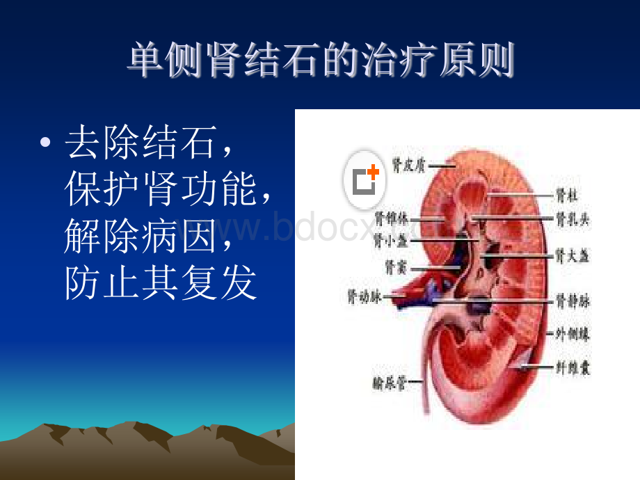 泌尿系结石的治疗.ppt_第3页