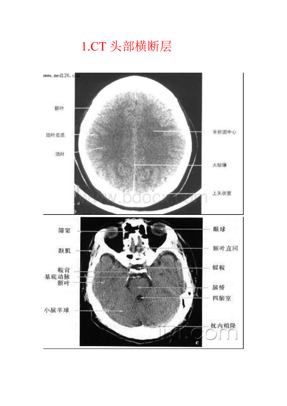 人体断面与影像解剖学_精品文档.doc_第1页