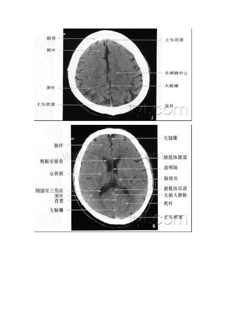 人体断面与影像解剖学_精品文档.doc_第2页