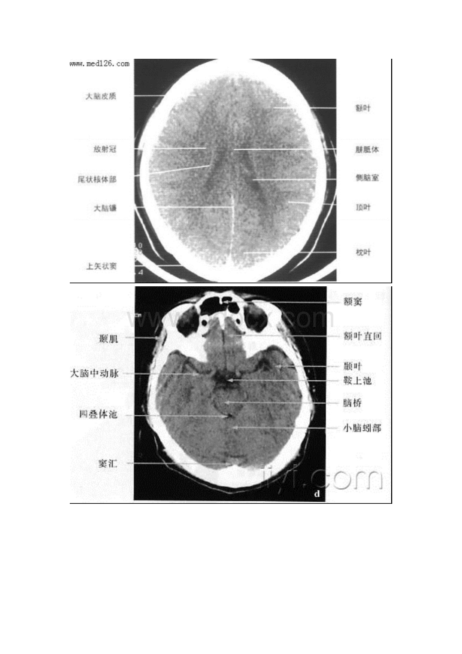 人体断面与影像解剖学_精品文档.doc_第3页