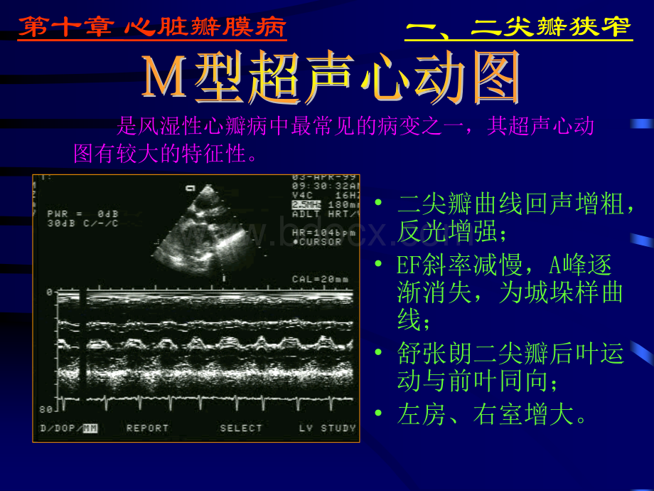 异常超声心动图.ppt_第3页