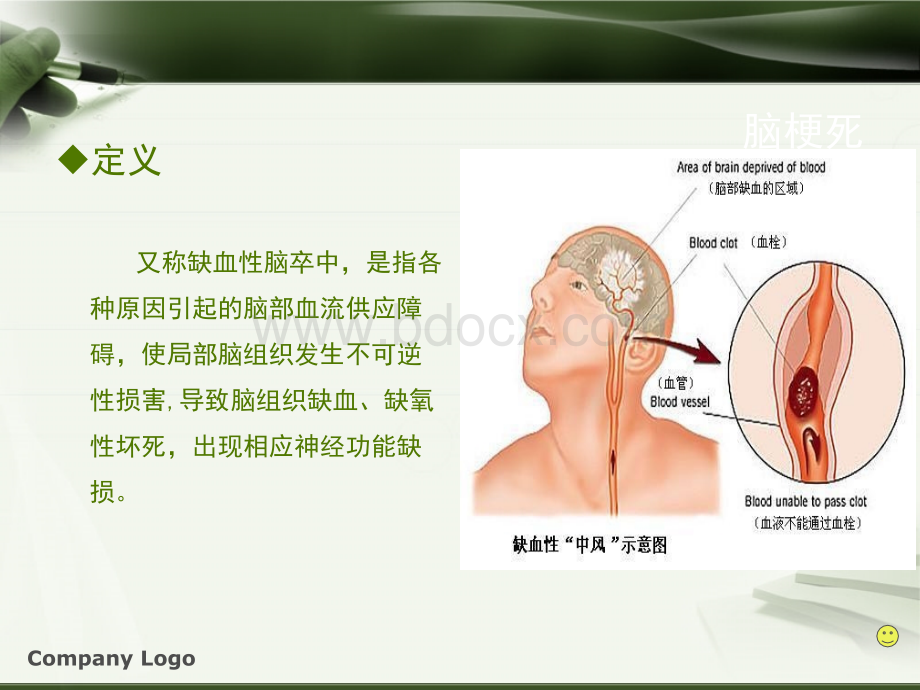 脑梗死诊治规范_精品文档.ppt_第3页