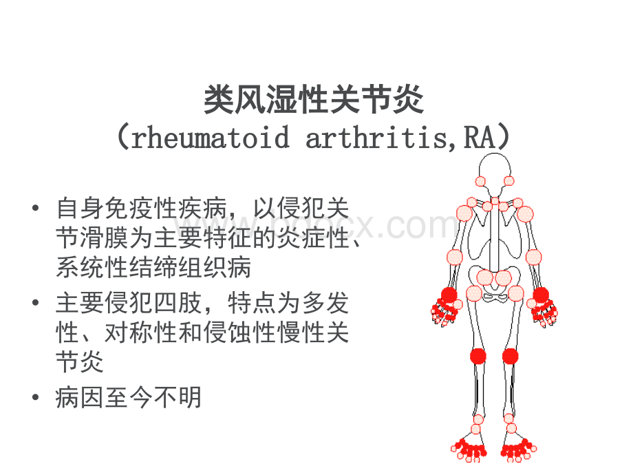 类风湿性炎的影像学诊断PPT资料.ppt_第2页