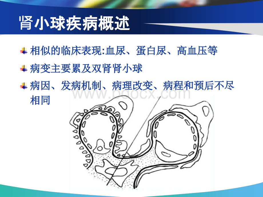 肾小球肾炎病人的护理优质PPT.ppt_第3页