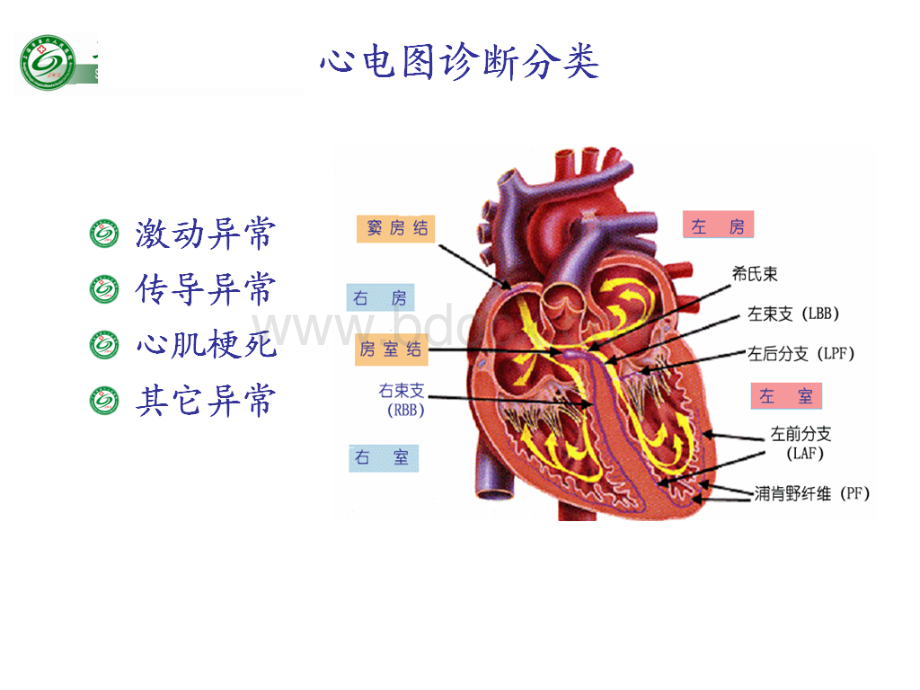 常见心电图ECG鉴别诊断.ppt_第2页