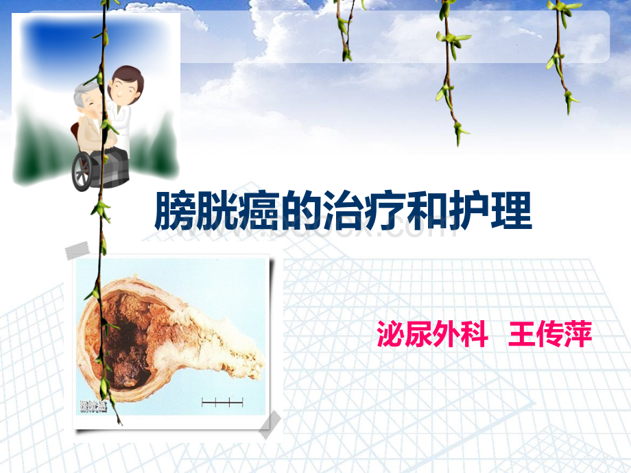 膀胱癌的治疗与护理_精品文档.ppt