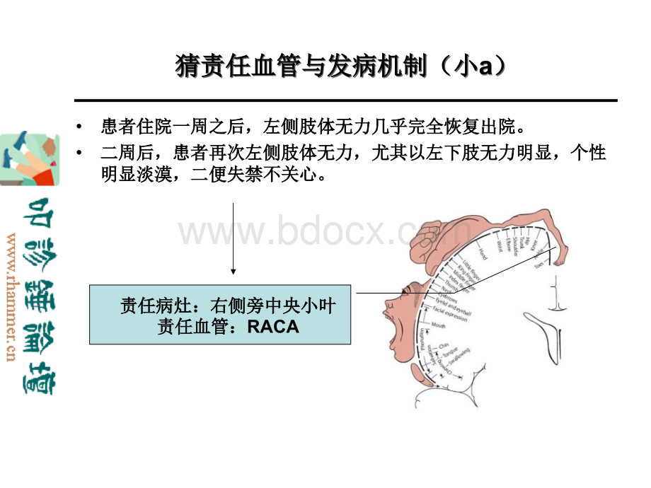 从影像学梗死部位推测责任供血血管PPT格式课件下载.ppt_第3页