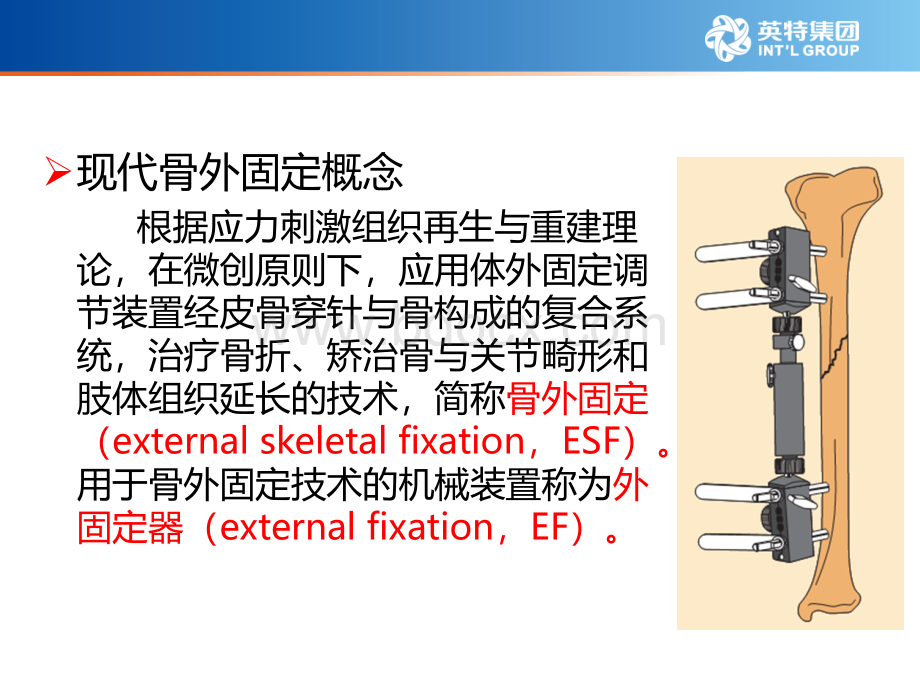 外固定架PPT资料.ppt_第3页