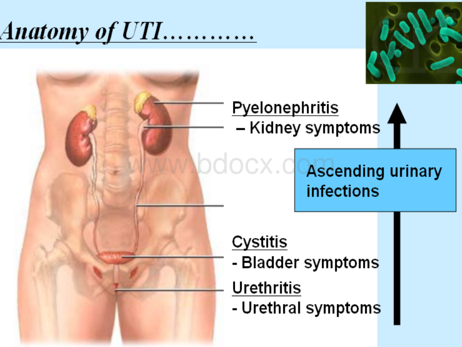 泌尿系感染的诊治.ppt_第3页