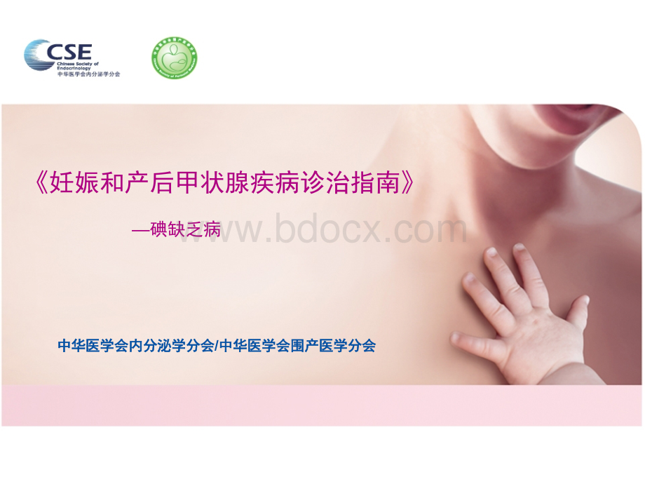 产后甲状腺疾病诊治指南-碘缺乏病.ppt_第1页