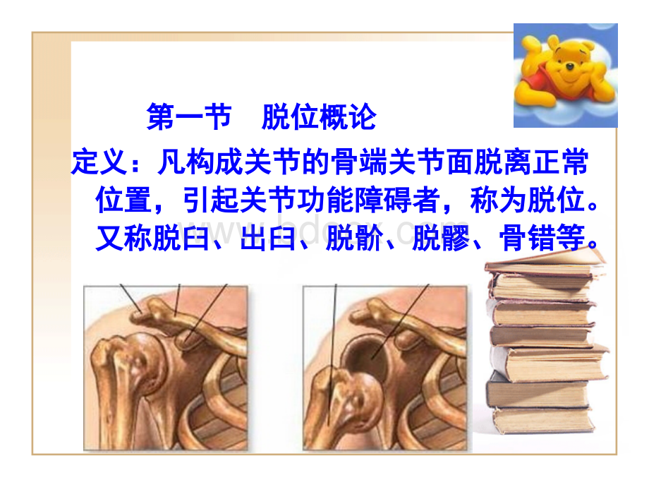 传统康复学关节复位疗法优质PPT.ppt_第3页