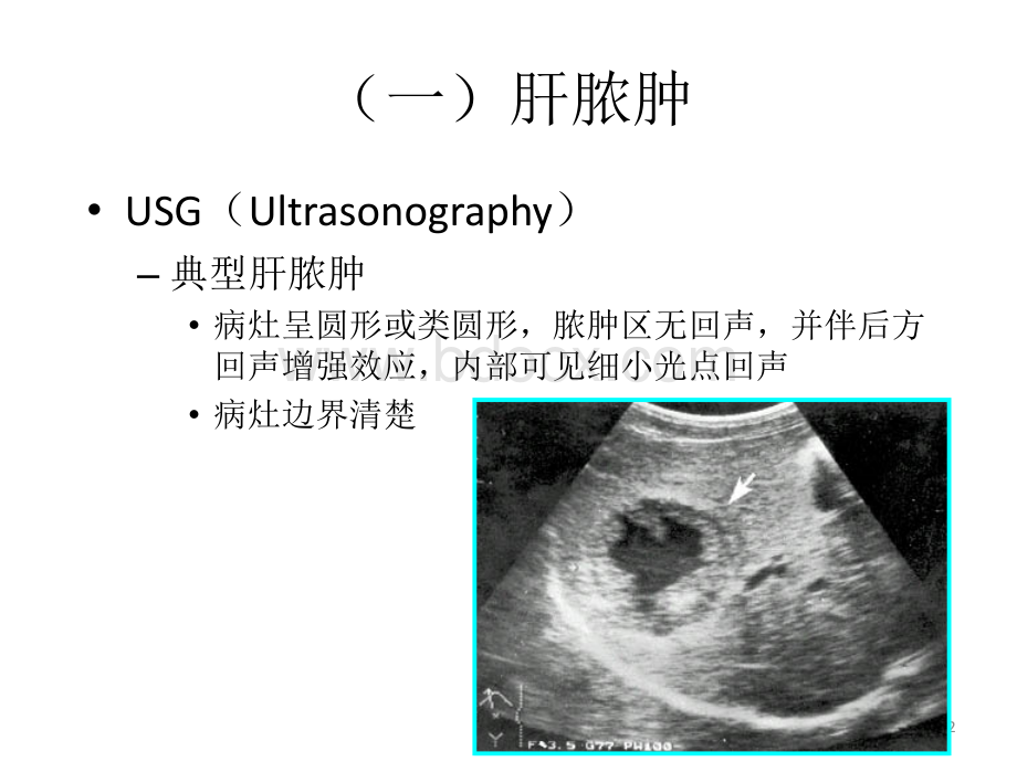 腹部疾病的诊断_精品文档.ppt_第2页