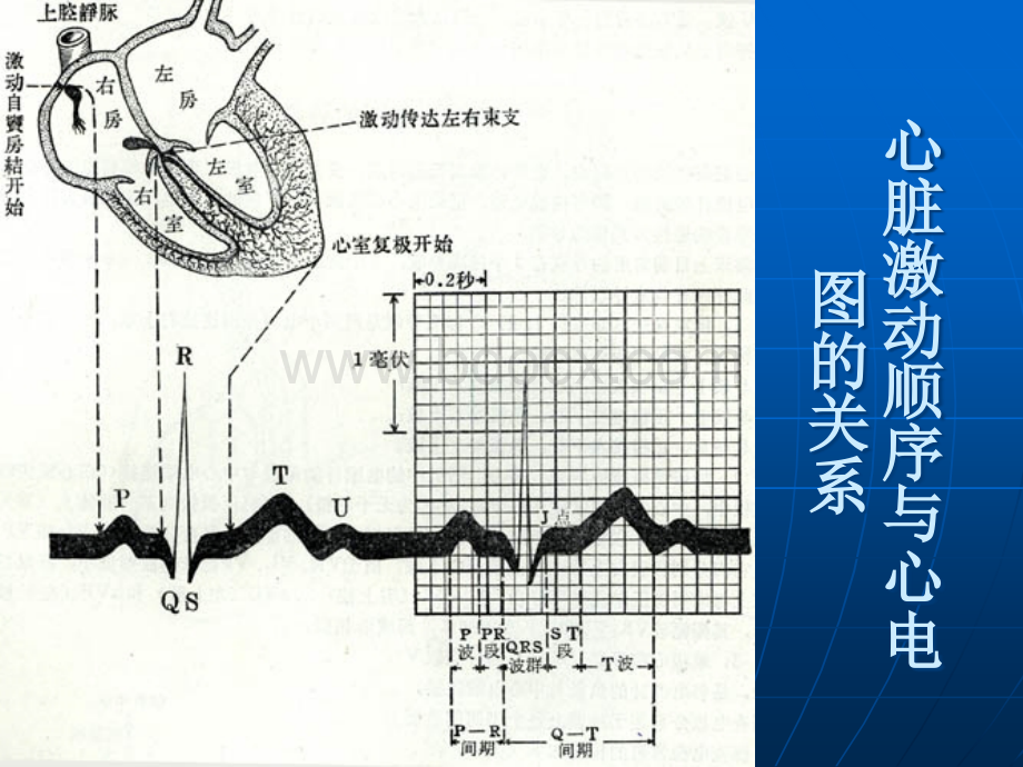 常见异常心电图及临床处理.ppt_第3页