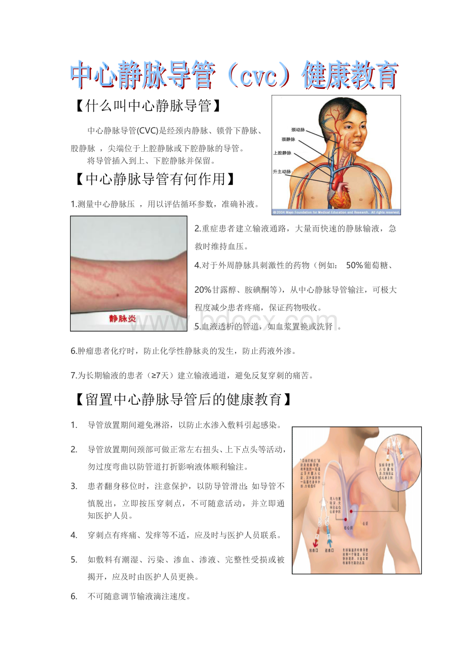 CVC健康宣教_精品文档Word文档格式.doc