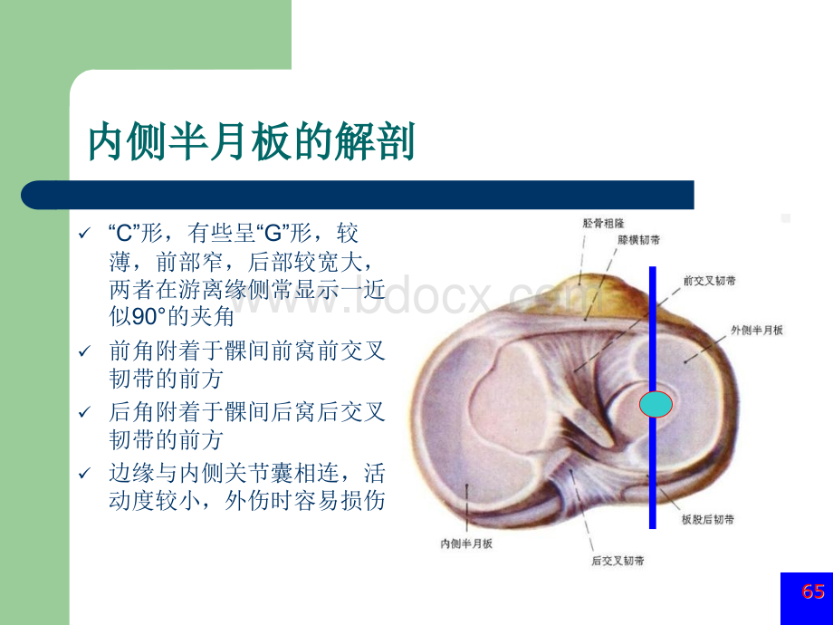 膝关节半月板损伤MRI诊断ppt_精品文档PPT推荐.ppt_第2页