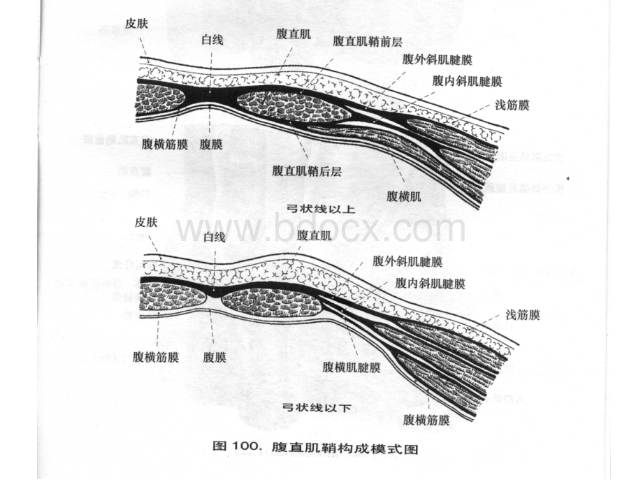 腹横肌平面阻滞_精品文档.ppt_第3页