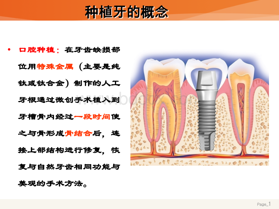 种植牙基础优质PPT.ppt