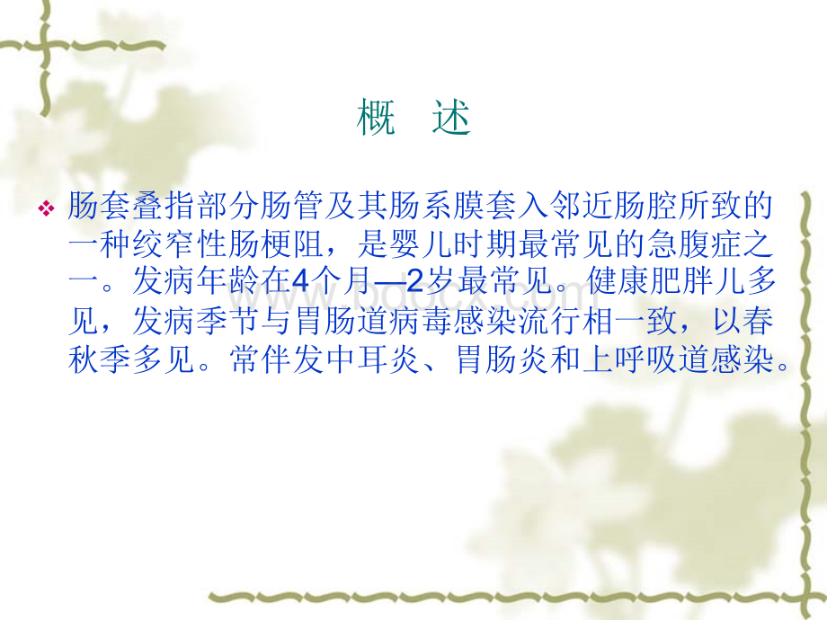 小儿肠套叠的影像.ppt_第2页