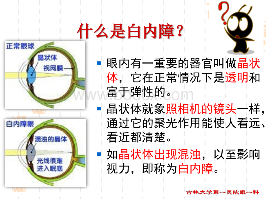 白内障科普讲座PPT文档格式.ppt_第3页